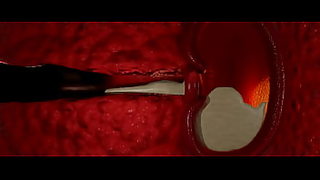 1st night full hd xxxvideo download